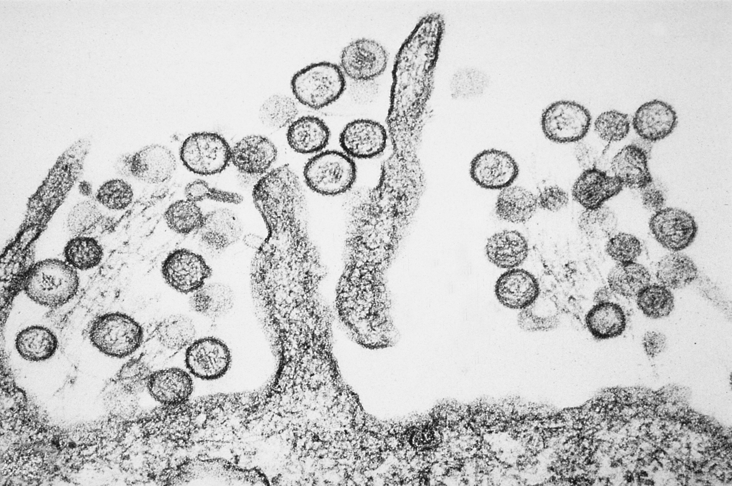 Micrografía electrónica de un hantavirus del grupo Sin Nombre