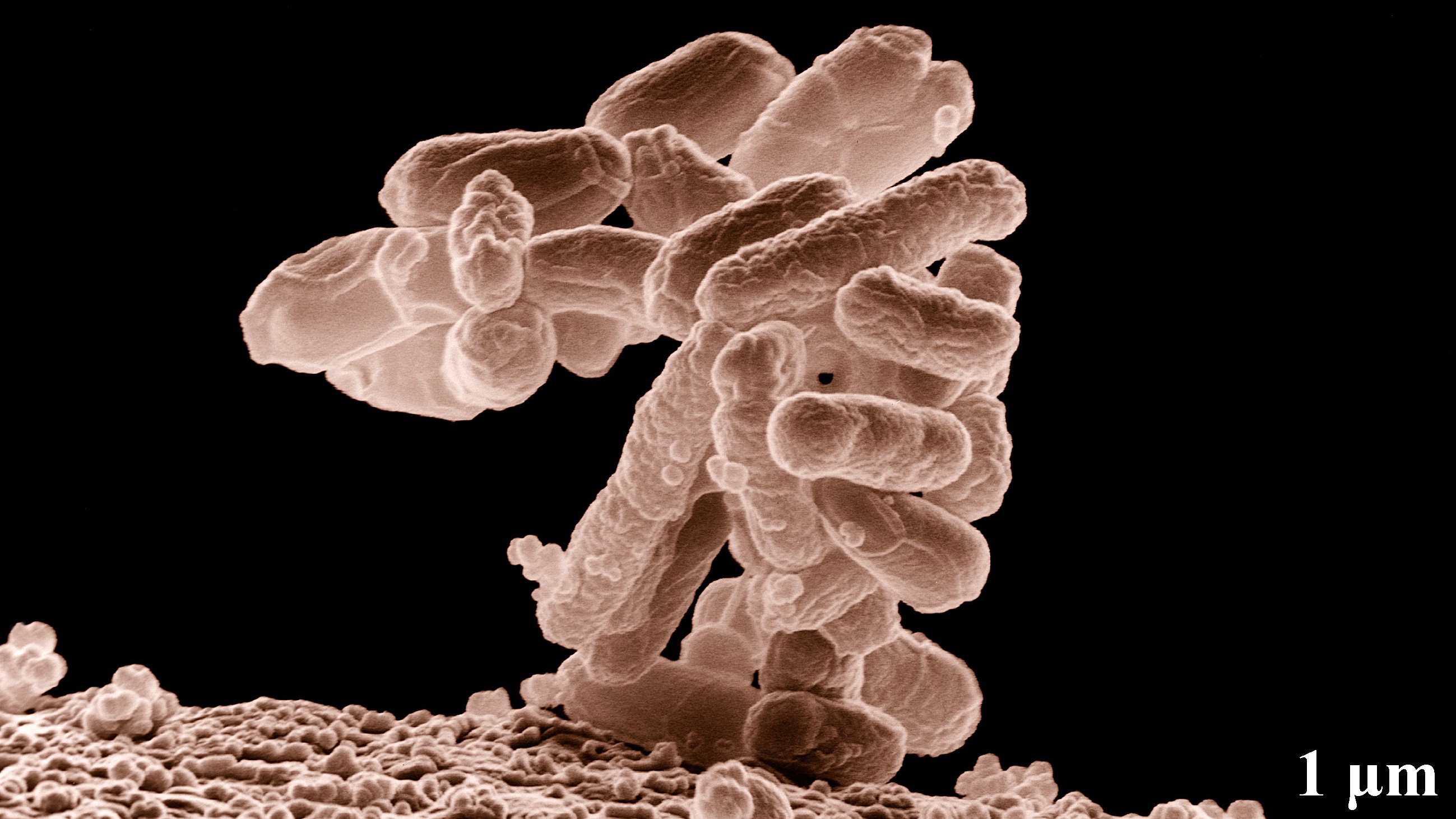 Una bacteria intestinal convierte un contaminante industrial en una molécula que enciende la inflamación. Harvard acaba de conectar eso con la depresión.