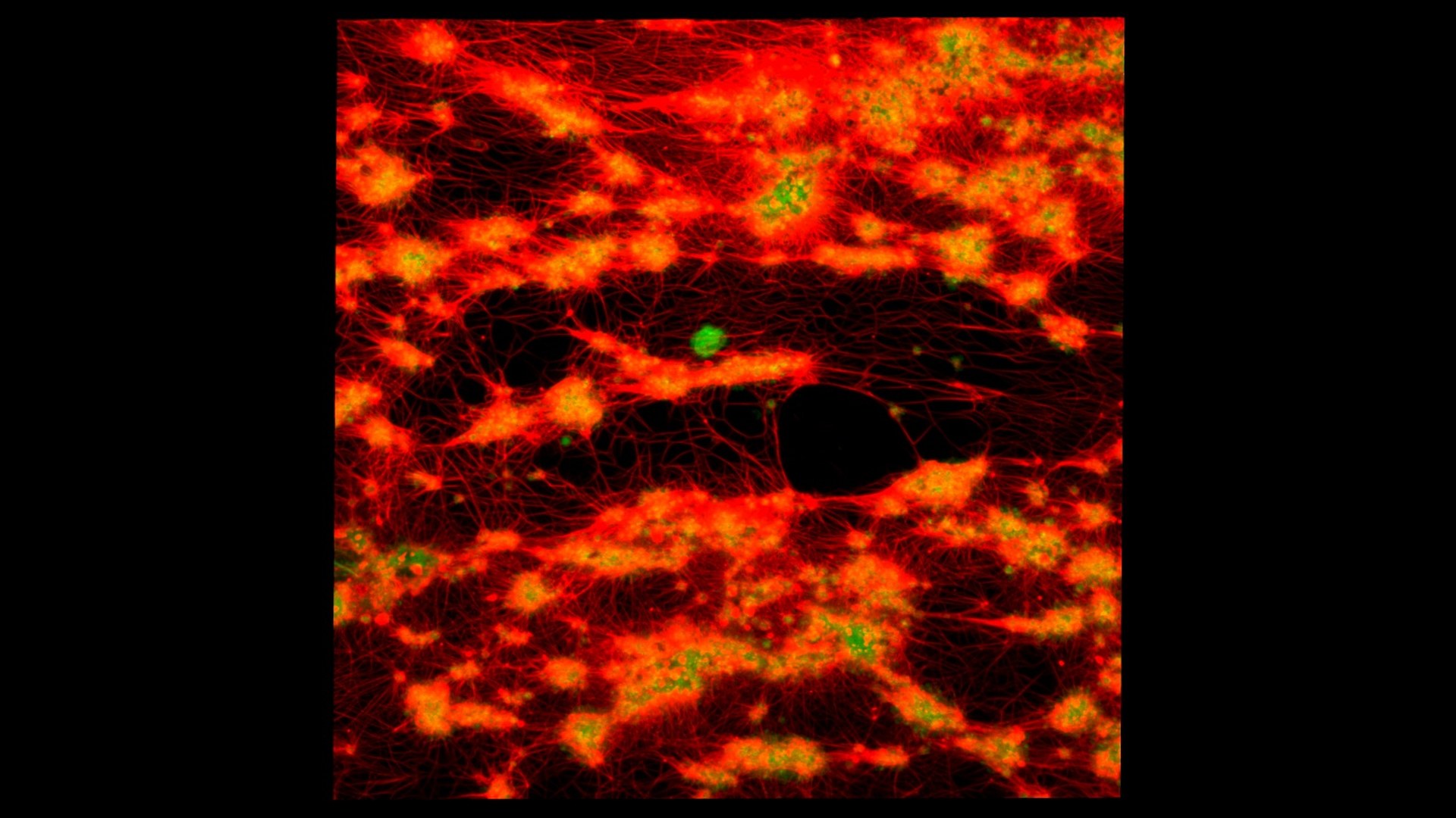 Cinco segundos para detener una hemorragia. El coágulo diseñado en laboratorio que es 13 veces más resistente que el natural.