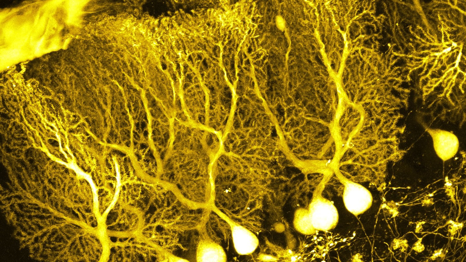 Una startup australiana abrió el primer data center del mundo parcialmente alimentado por neuronas humanas cultivadas en laboratorio