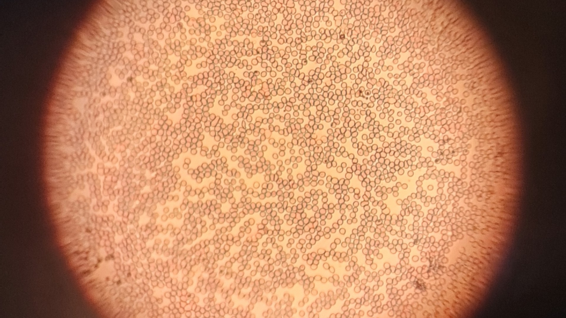 En Argentina detectaron seis casos de uno de los grupos sanguíneos más raros del mundo. La confirmación vino de Japón.