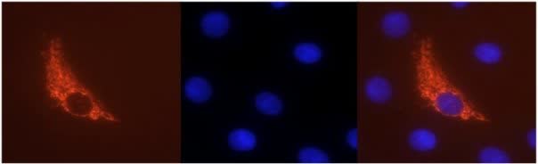 Tus mitocondrias hacen collares de perlas para ordenar su ADN