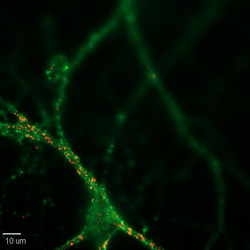 Durante décadas los científicos creyeron que el cerebro adulto no cambiaba. Estaban completamente equivocados.